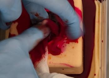 Szkolenie Stop the bleed dla ratowników Fundacji